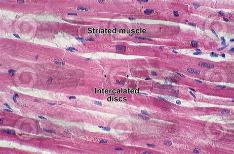 Cardiac Muscle Under Microscope Labeled