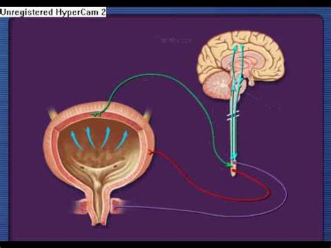 Ramayya Pramila Urology Hospital: MICTURITION SYNCOPE: A RARE CASE