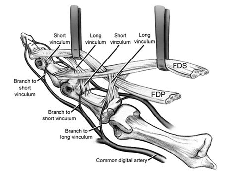 Flexor Tendon Injuries - Lessons - Blendspace