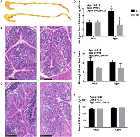 | (a) Representative images of cecum and colon in mice fed either a low ...