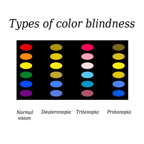 Understanding the Spectrum of Color Blindness - Facty Health