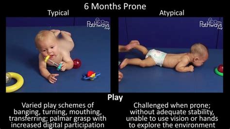 Watch 6 Month Old Typical & Atypical Motor Development Side by Side