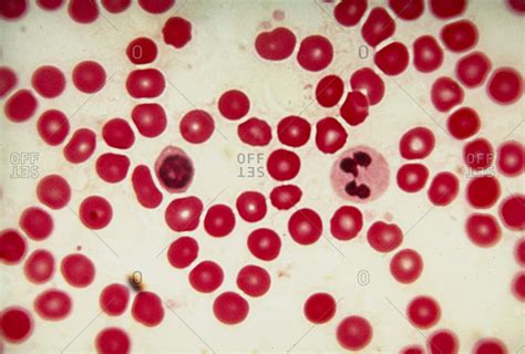 Light micrograph of human red blood cells (erythrocytes), with two ...