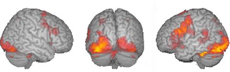 Functional Magnetic Resonance Imaging (fMRI) | Thesen Lab