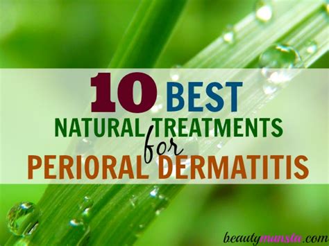 Top 10 Natural Remedies for Perioral Dermatitis (Including Recipes ...