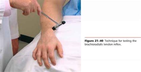 Brachioradialis Reflex