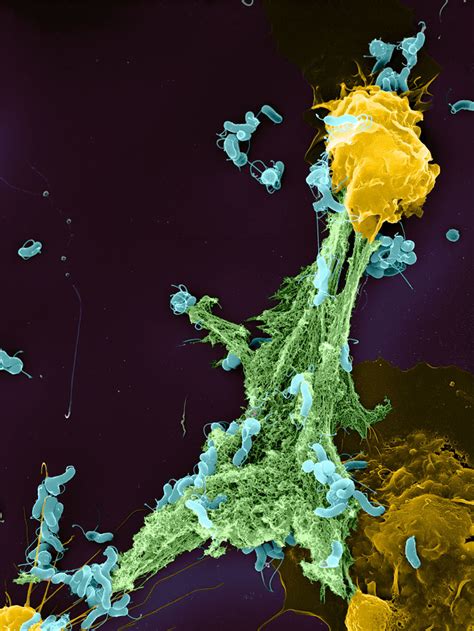 Neutrophil Extracellular Traps | Arteriosclerosis, Thrombosis, and ...