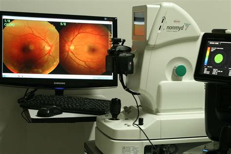 Retinal Photography | Retinal Tears Diagnosis and Treatment