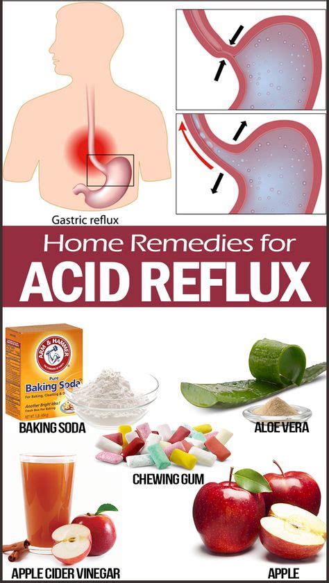 30 Home Remedies for Acid Reflux | Remedies | Home remedies for ...