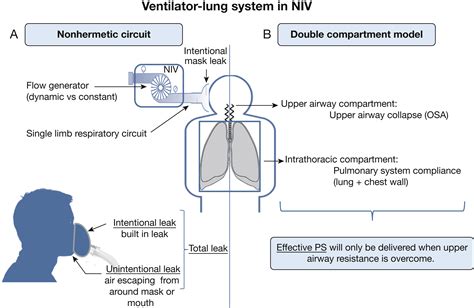 Initiation of Noninvasive Ventilation for Sleep Related Hypoventilation ...