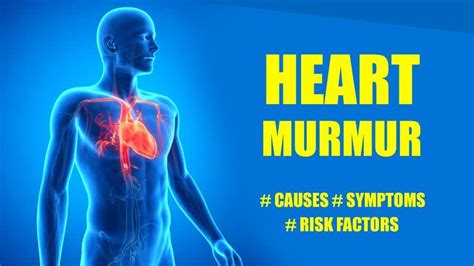 Heart Murmurs – Common Heart Murmurs Symptoms and Causes for Systolic ...