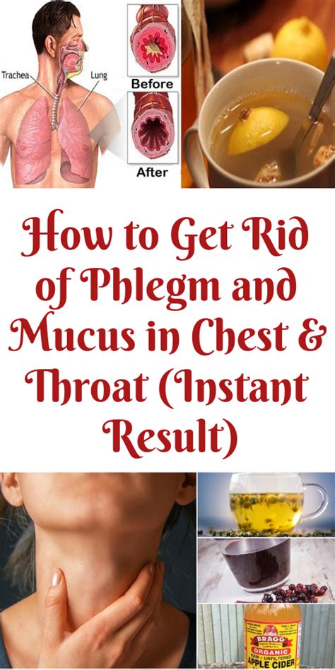 Home Remedies For Phlegm In Throat