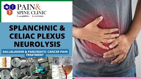 Splanchnic & Celiac plexus Neurolysis( Procedure) - YouTube