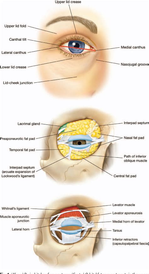 [PDF] Functional considerations in aesthetic eyelid surgery. | Semantic ...