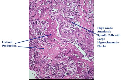 Diagrams Histology And Histophathology