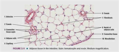 Gambar Biologi Gonzaga Jaringan Hewan Gambar Kartilago Fibrosa Tulang ...