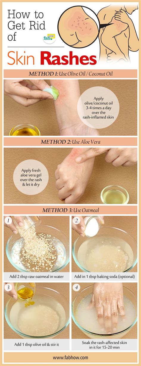 55 best Heat Rash images on Pinterest | Heat rash, Health remedies and ...