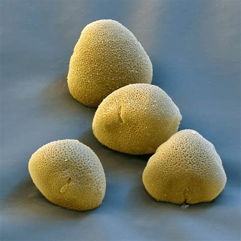 Pollen Grains Under Microscope | Amusing Planet