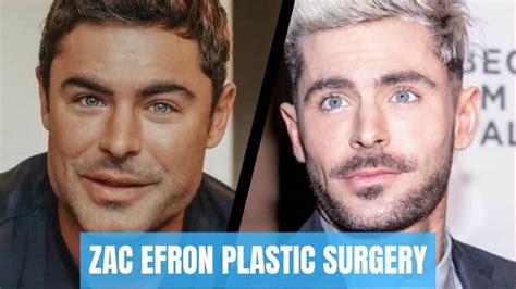 Did Zac Efron Get Plastic Surgery? Everything You Need To Know