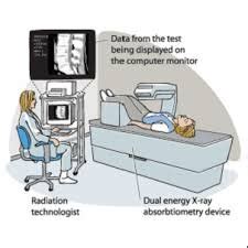 DEXA (DXA) Scan: Bone Mineral Density Test Purpose, procedure