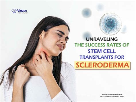 Success Rates of Stem Cell Transplants for Scleroderma