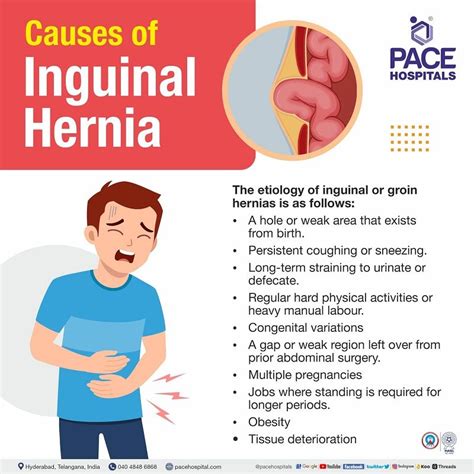 Inguinal Hernia - Signs and Symptoms, Types, Causes, Risk Factors