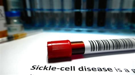 FDA approves sickle cell disease treatment that uses ‘remarkable’ gene ...