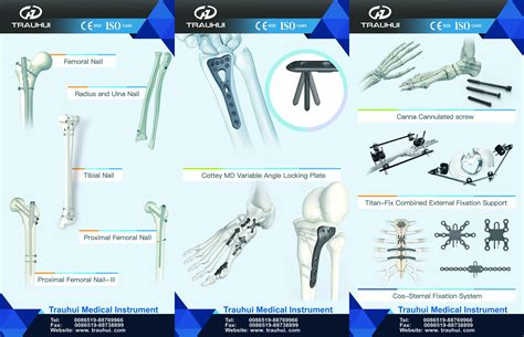 Combined External Fixator Orthopedic Implant Hoffman External Fixator ...