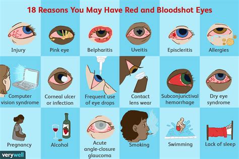 How to Treat and Get Rid of Red Eyes