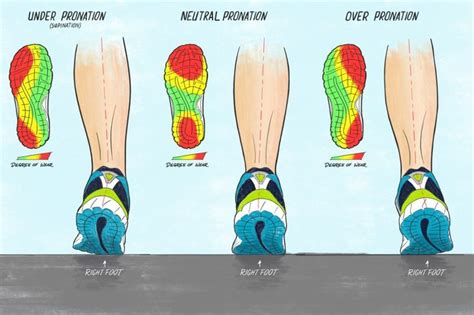 Types of Pronation | Determine your type here Pronation defines the ...