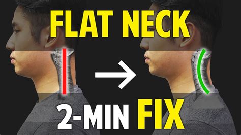 Fix Flat Neck(Cervical Kyphosis)｜Neck Correction｜Balancing Exercises ...