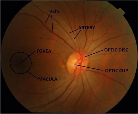 Ocular Fundus Labeled