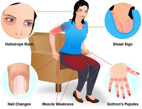 60F presents with weakness and you examine their upper limbs. You ...