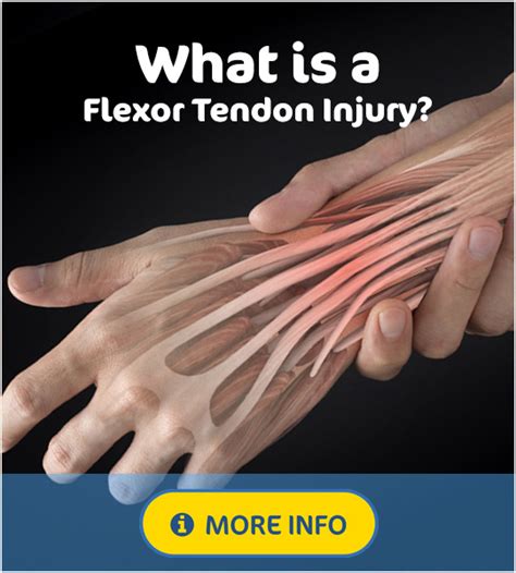 Finger Flexor Tendon Injuries