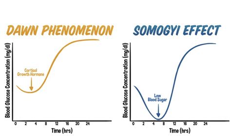 Unveiling the Differences: The Dawn Phenomenon vs. The Somogyi Effect ...