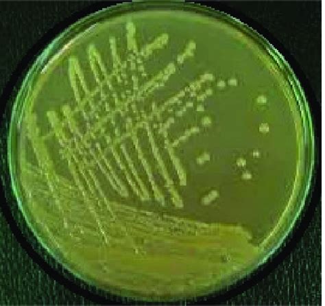 Showing P. aeruginosa Growth on Citrimide Agar Plates. | Download ...