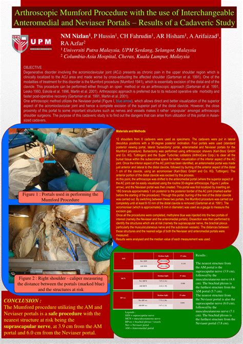 (PDF) Arthroscopic Mumford Procedure with the Use of Interchangeable ...