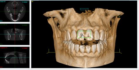 “Cone Beam 3D Imaging in Springboro & Dayton in Springboro & Dayton ...