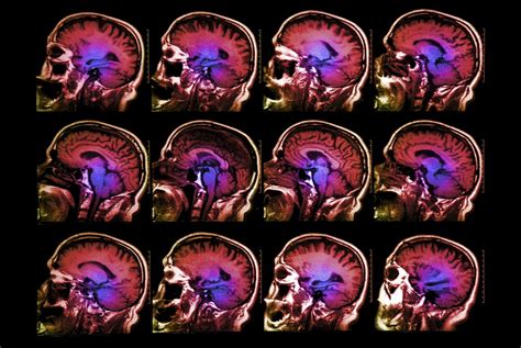 fMRI software bug could invalidate 15 years of brain scans | WIRED UK