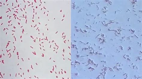 Pseudomonas Aeruginosa Under Microscope (Gram Staining) | Pseudomonas ...