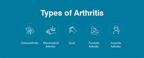 Types of Arthritis - Apollo Clinic Blog