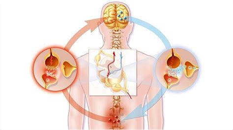 The Best Ways to Treat and Control Neuropathic Pain - Pinnacle Marketing