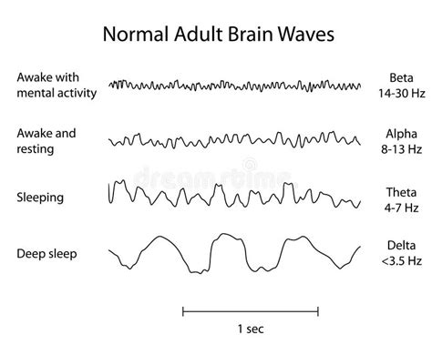 Normal Brain Waves EEG stock vector. Illustration of diagram - 29444815