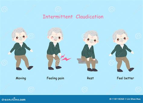 Man with Intermittent Claudication Stock Illustration - Illustration of ...