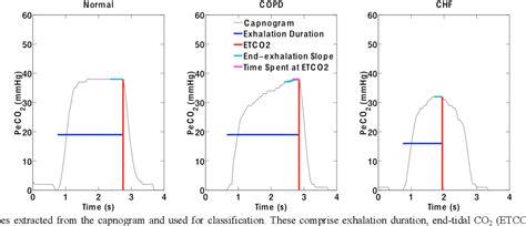 Figure 1 from Automated Quantitative Analysis of Capnogram Shape for ...