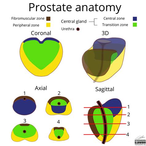 Prostate Gland Anatomy Mri