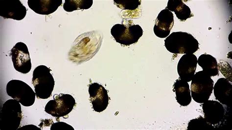 Wimpertierchen - Ciliophora - Ciliata - Ciliate - microorganisms under ...