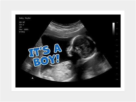 Gender Reveal "It's a Boy" | Fake Ultrasound w/ Instant Download!