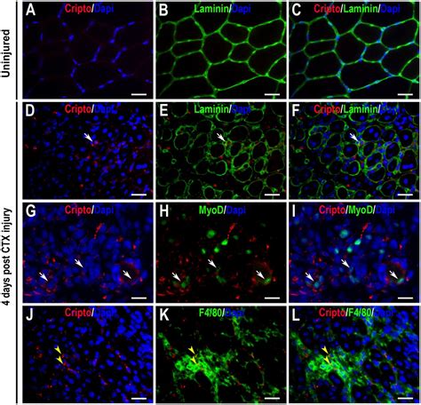 Cripto regulates skeletal muscle regeneration and modulates satellite ...