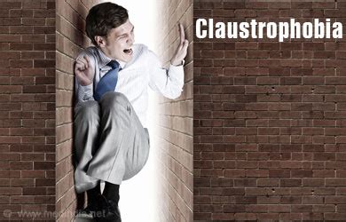 Claustrophobia - Causes, Symptoms, Diagnosis, Treatment, Prevention